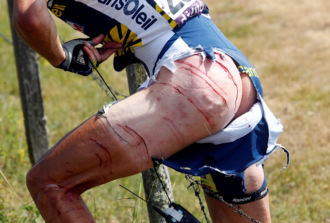 Le impressionanti lacerazioni sul corpo e sulla divisa di Hoogerland nella nona tappa del Tour © Bettiniphoto
